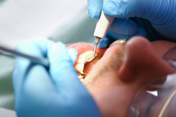 Best Broken or Chipped Tooth Repair in Abingdon, IL
