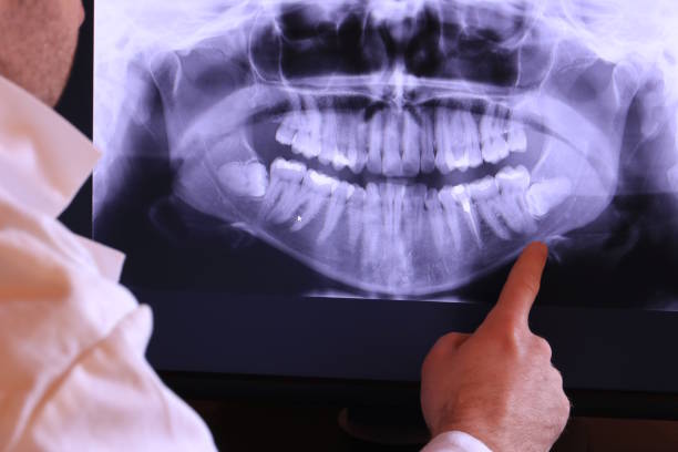 Best Dental Abscess Treatment in Abingdon, IL